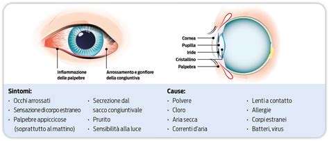Occhio con segni di arrossamento e gonfiore, tipici dell'herpes oculare