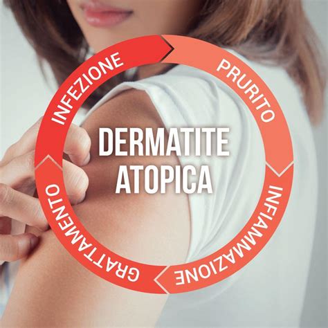 Impatto della dermatite atopica sulla vita quotidiana