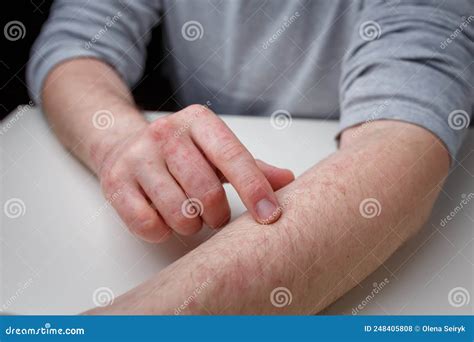 Paziente con prurito sulla pelle