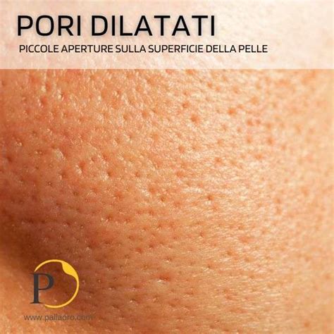 Schema comparativo tra pelle con pori dilatati e pelle con pori minimizzati