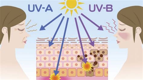 Diagramma che illustra i danni causati dall'esposizione ai raggi UV, inclusi invecchiamento precoce, scottature e aumento del rischio di cancro della pelle.
