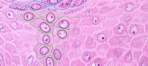 Micrografia di epitelio pavimentoso stratificato non cheratinizzato annotata digitalmente