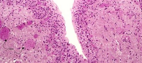 Micrografia di epitelio polimorfo o di transizione annotata digitalmente
