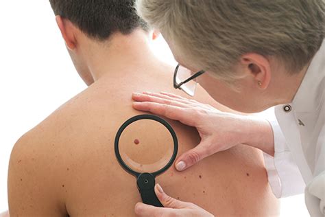 Paziente che si sottopone a controllo dermatologico