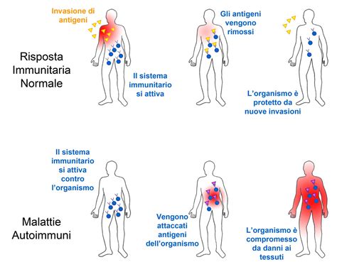 Schema del sistema immunitario e malattie autoimmuni