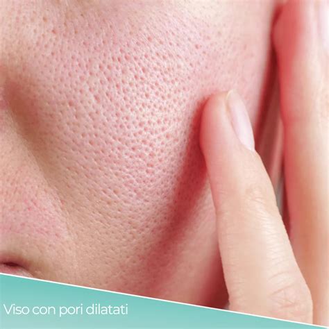 Esempio di prodotti per la cura della pelle con pori dilatati