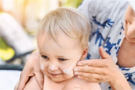 Bambino con pelle atopica che applica crema solare