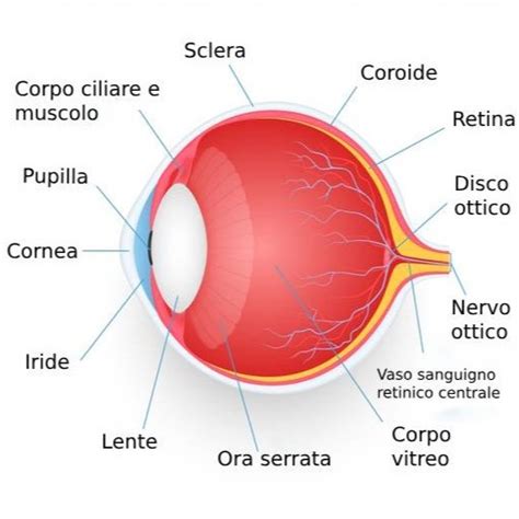 Diagramma che illustra la formazione di una cicatrice corneale dopo un'ulcera