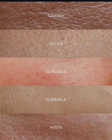 Pelle mista con zone lucide e zone secche