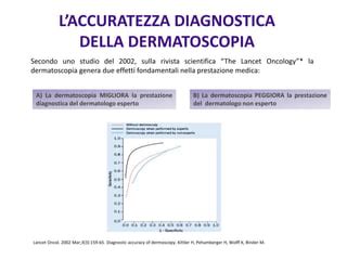 Dermoscopia per la diagnosi del melanoma