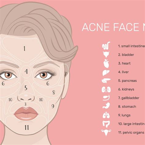 Infografica che illustra i diversi tipi di trattamenti topici per l'acne