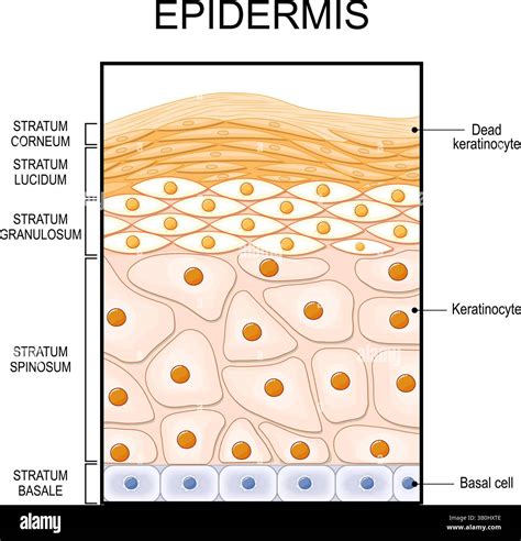 Schema di un'epidermide con le cellule infettate da HPV