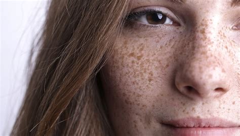 Viso femminile con lentiggini finte