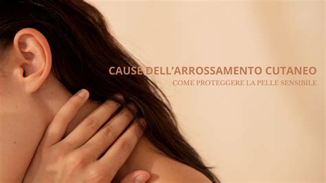 Schema delle cause dell'arrossamento cutaneo del viso