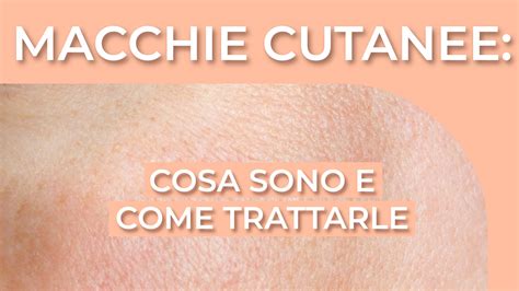 diverse tipologie di macchie cutanee