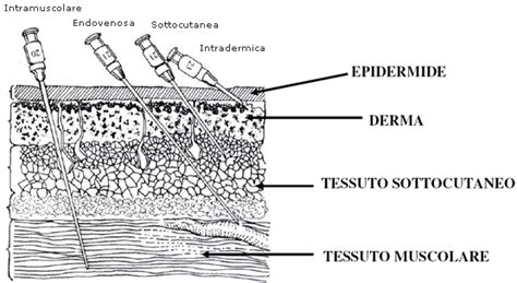 Schema che illustra diverse vie di somministrazione di farmaci, con enfasi sull'iniezione intramuscolare ed endovenosa