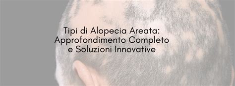 Immagine che mostra diverse manifestazioni di alopecia areata: chiazza sul cuoio capelluto, perdita di sopracciglia e barba