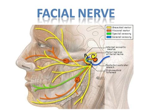 Sezione dell'osso temporale che mostra il decorso del nervo faciale
