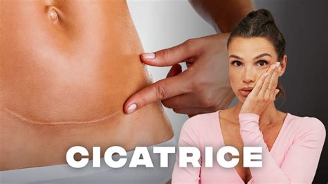 Cicatrice chirurgica sul seno