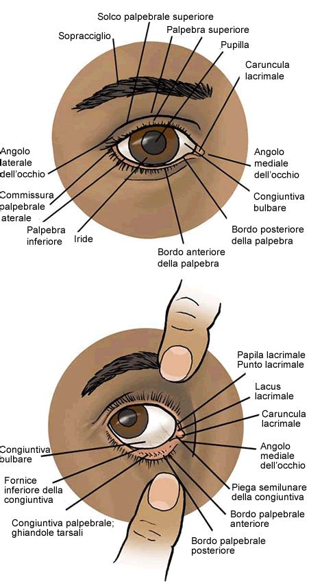 Ingrandimento del bordo palpebrale con squame e croste alla base delle ciglia