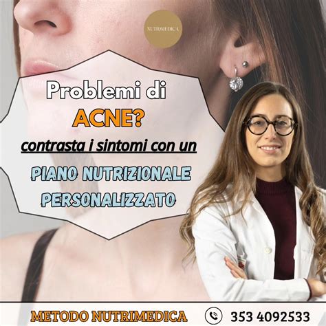 Infografica che illustra i fattori che contribuiscono all'acne: ormoni, stress, dieta, genetica, cosmetici