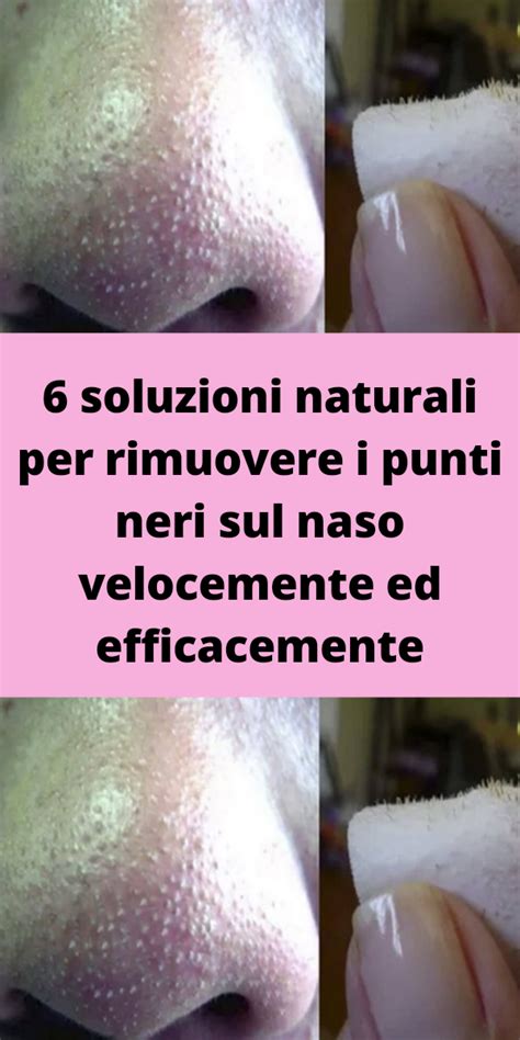 illustrazione di un naso con punti neri