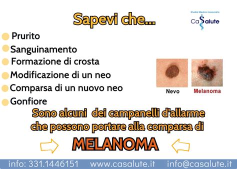 Esempio di melanoma a diffusione superficiale con bordi irregolari
