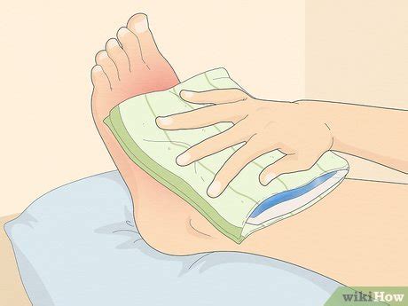 Illustrazione che mostra come applicare correttamente il ghiaccio su una contusione