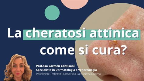 Illustrazione di diverse manifestazioni di cheratosi attinica su varie parti del corpo