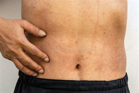 Illustrazione di diverse cause di prurito sulla pelle