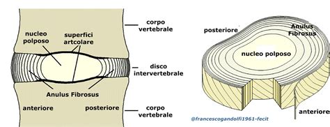 Struttura di un disco intervertebrale con nucleo polposo e anulus fibrosus