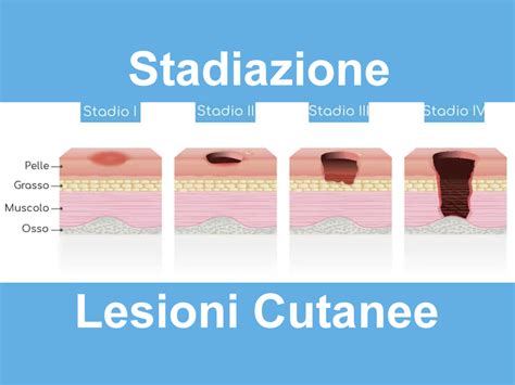 Schema che illustra le diverse tipologie di lesioni cutanee trattabili con Trofodermin