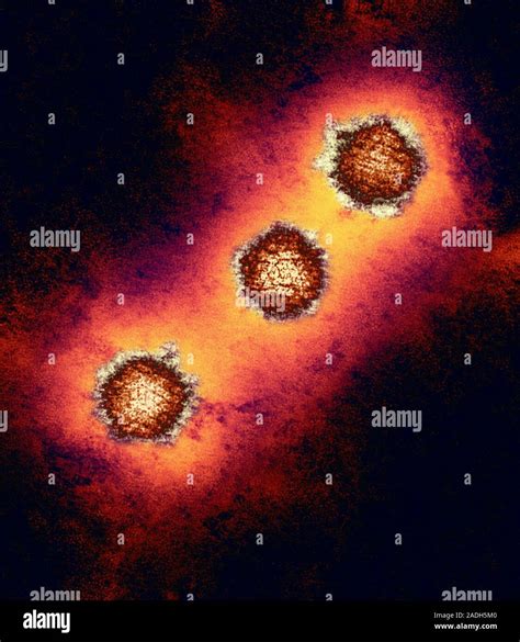 Microscopio elettronico di particelle virali di Herpes Simplex