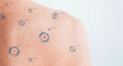 Diagramma che illustra le diverse fasi della mappatura dei nei
