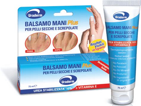 mani screpolate e crema