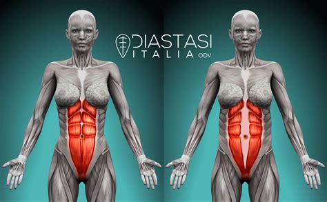 Diagramma anatomico dei muscoli retti addominali
