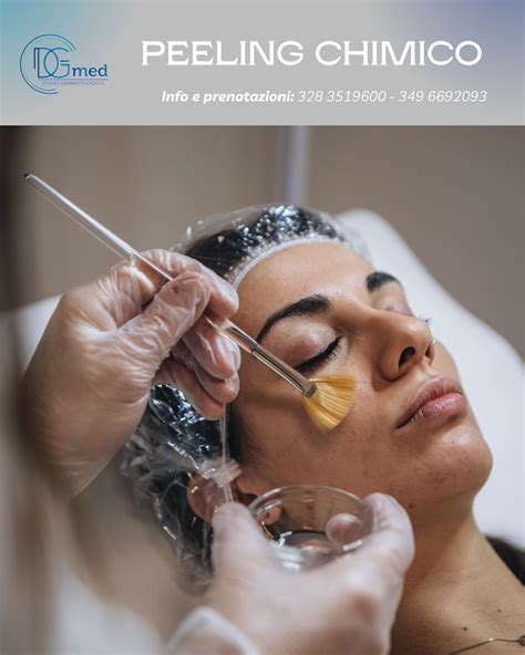 Paziente che mostra la pelle dopo un peeling chimico