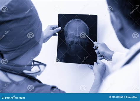 Chirurgo che esamina una scansione medica