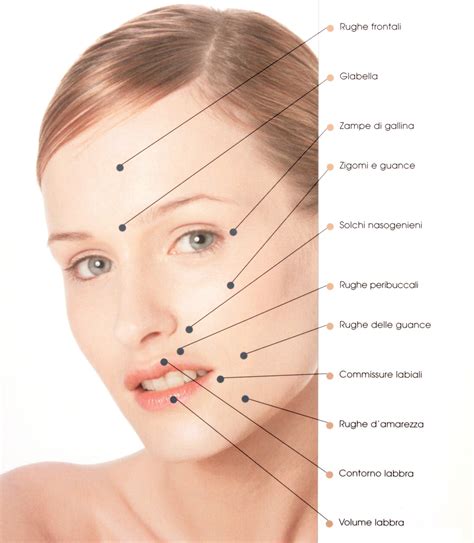 Schema anatomico del viso con punti di iniezione per filler