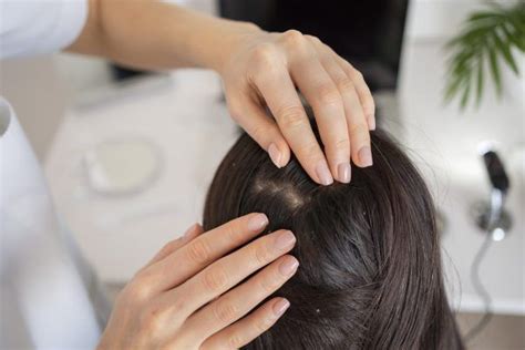 Strumenti per la diagnosi dell'alopecia