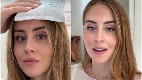 Chirurgo che esegue la rimozione di un neo