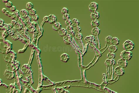 Illustrazione di funghi microscopici che attaccano la pelle e le unghie