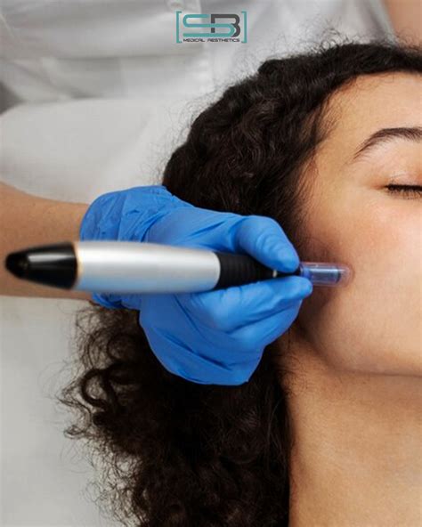 Immagine di una microcannula utilizzata in medicina estetica