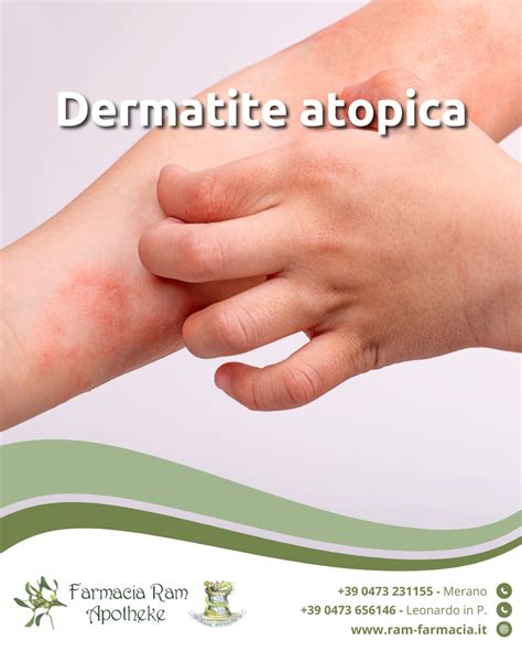 Illustrazione di una farmacia con antistaminici e creme emollienti