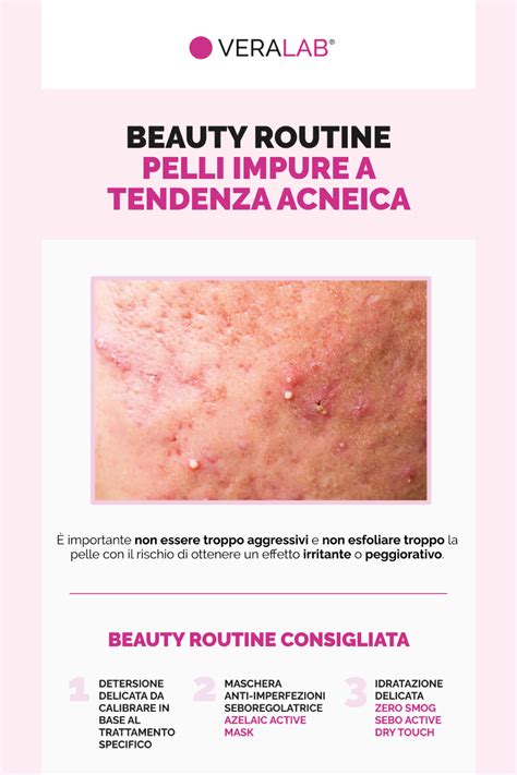 Schema di una routine di skincare per pelli impure