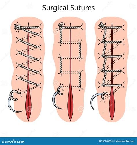 illustrazione chirurgica dermatologica