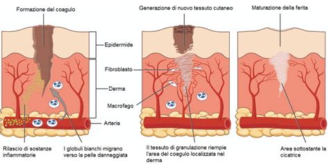 Processo di guarigione della pelle