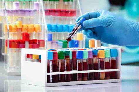 Laboratorio con provette e attrezzature per analisi del sangue