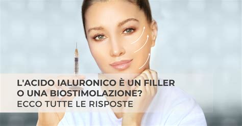 Siringa con filler di acido ialuronico