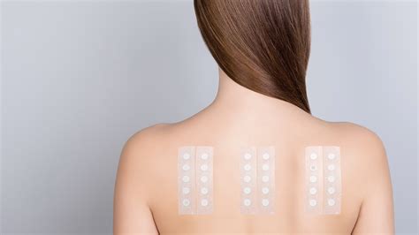 Schema di un patch test per allergia cutanea
